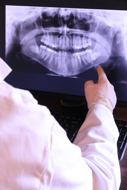 Best Emergency Treatment for Dental Infections or Abscesses in Altamont, TN